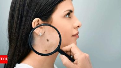 Understanding the hidden meanings of lucky moles on the female body.
